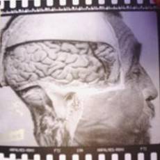 Napalmed : Napalmed - RBNX